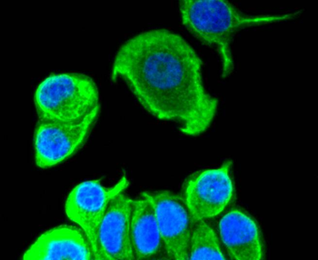 Cytokeratin 8 Recombinant Rabbit Monoclonal Antibody