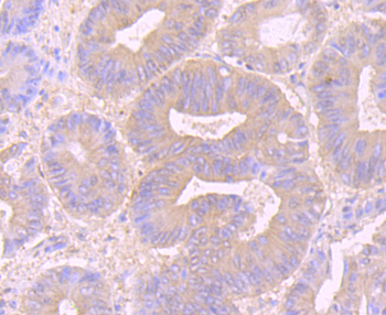 Desmoglein 2 Recombinant Rabbit Monoclonal Antibody