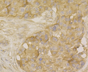 MARK3 Recombinant Rabbit Monoclonal Antibody