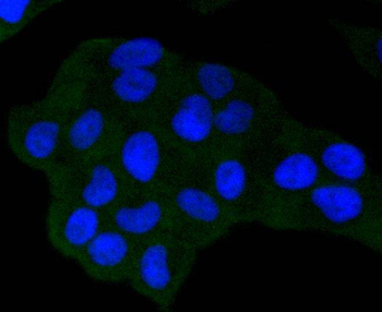 NADPH oxidase 4 Recombinant Rabbit Monoclonal Antibody