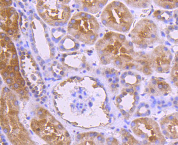 NADPH oxidase 4 Recombinant Rabbit Monoclonal Antibody