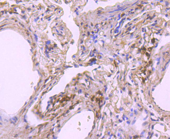 NADPH oxidase 4 Recombinant Rabbit Monoclonal Antibody