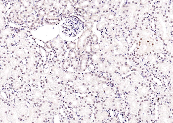 NADPH oxidase 4 Recombinant Rabbit Monoclonal Antibody