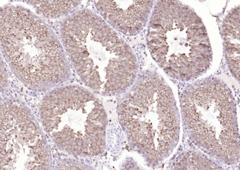 TSG101 Recombinant Rabbit Monoclonal Antibody