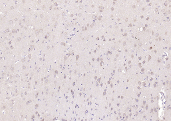 TSG101 Recombinant Rabbit Monoclonal Antibody