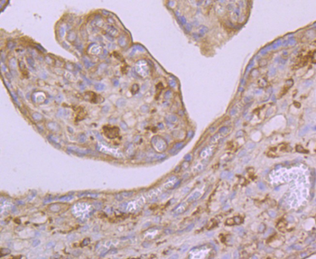 ARP3 Recombinant Rabbit Monoclonal Antibody