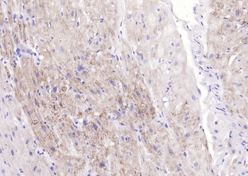 PDPK1 Recombinant Rabbit Monoclonal Antibody