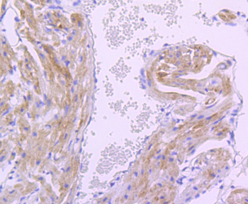 PDPK1 Recombinant Rabbit Monoclonal Antibody