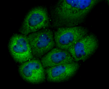 GCLM Recombinant Rabbit Monoclonal Antibody