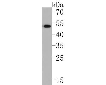 IL13RA1 Recombinant Rabbit Monoclonal Antibody