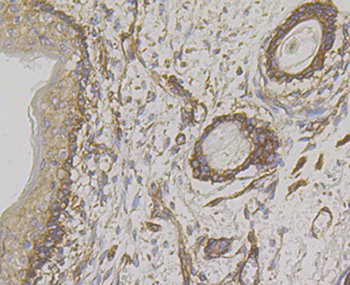 WNK1 Recombinant Rabbit Monoclonal Antibody