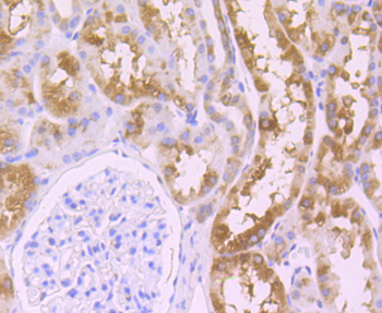 Wnt2b Recombinant Rabbit Monoclonal Antibody
