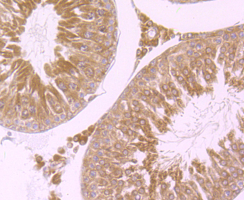 Wnt2b Recombinant Rabbit Monoclonal Antibody