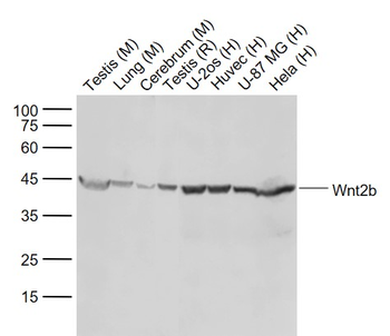 Wnt2b Recombinant Rabbit Monoclonal Antibody