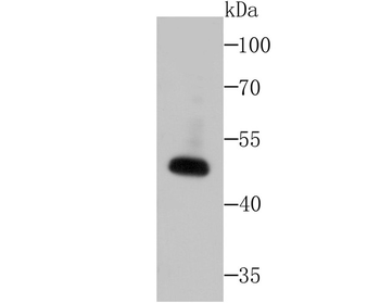 Wnt2b Recombinant Rabbit Monoclonal Antibody