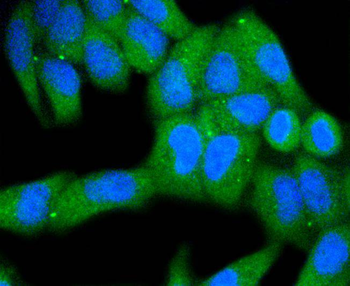 MKLP1 Recombinant Rabbit Monoclonal Antibody