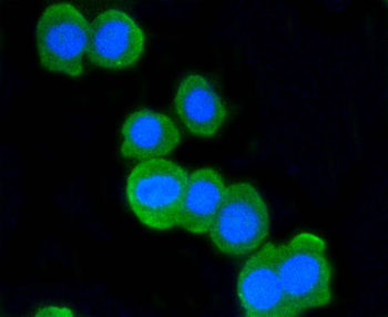 ATM Recombinant Rabbit Monoclonal Antibody