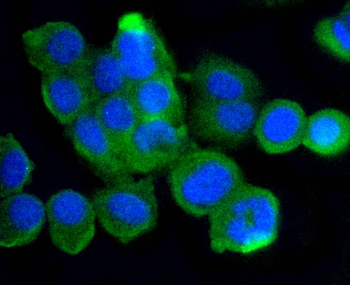 ATM Recombinant Rabbit Monoclonal Antibody