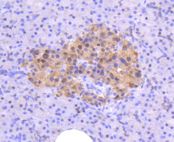ATM Recombinant Rabbit Monoclonal Antibody