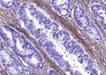 Collagen I Recombinant Rabbit Monoclonal Antibody
