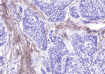 Collagen I Recombinant Rabbit Monoclonal Antibody