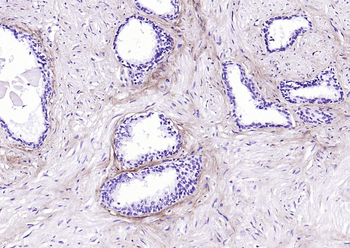 Collagen I Recombinant Rabbit Monoclonal Antibody