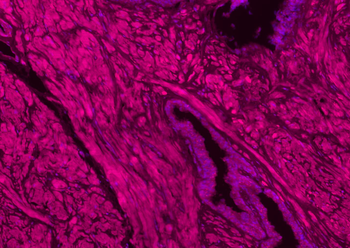 Collagen I Recombinant Rabbit Monoclonal Antibody