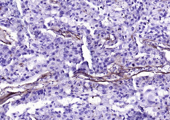 Collagen I Recombinant Rabbit Monoclonal Antibody