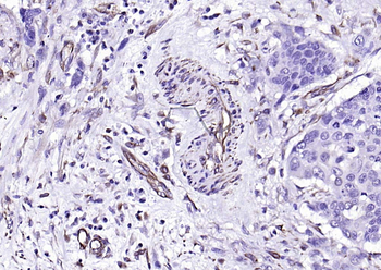 ACE2 Mouse Monoclonal Antibody