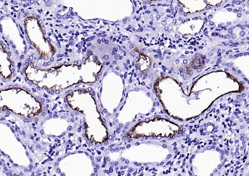 ACE2 Mouse Monoclonal Antibody