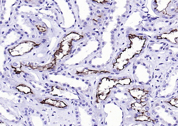 ACE2 Mouse Monoclonal Antibody