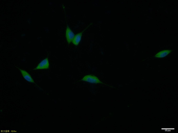 ACE2 Mouse Monoclonal Antibody
