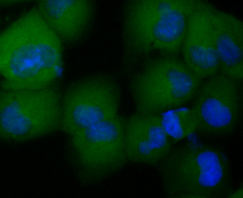 RANTES Recombinant Rabbit Monoclonal Antibody