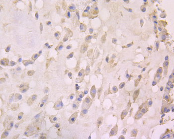 RANTES Recombinant Rabbit Monoclonal Antibody