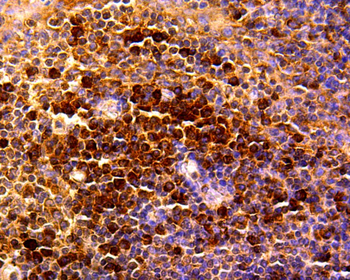 RANTES Recombinant Rabbit Monoclonal Antibody