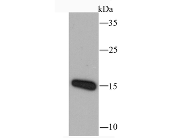 RANTES Recombinant Rabbit Monoclonal Antibody
