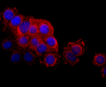 LYVE1 Recombinant Rabbit Monoclonal Antibody