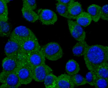 PMP22 Recombinant Rabbit Monoclonal Antibody