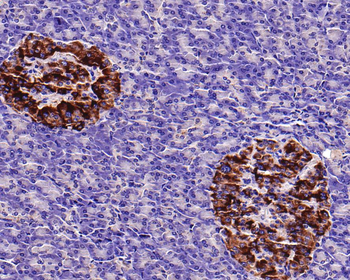PMP22 Recombinant Rabbit Monoclonal Antibody