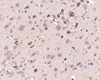 PMP22 Recombinant Rabbit Monoclonal Antibody