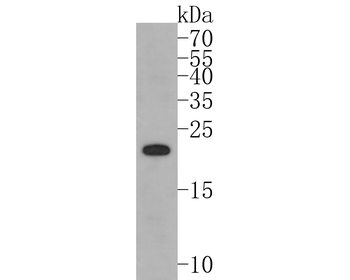 PMP22 Recombinant Rabbit Monoclonal Antibody