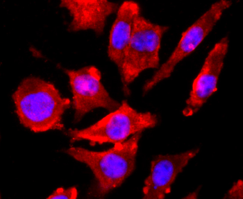 NMDAR1 Recombinant Rabbit Monoclonal Antibody