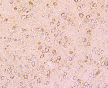 DRD1 Recombinant Rabbit Monoclonal Antibody