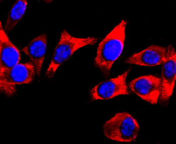 DRD1 Recombinant Rabbit Monoclonal Antibody