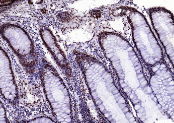 Bub3 Recombinant Rabbit Monoclonal Antibody