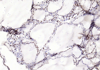 Bub3 Recombinant Rabbit Monoclonal Antibody