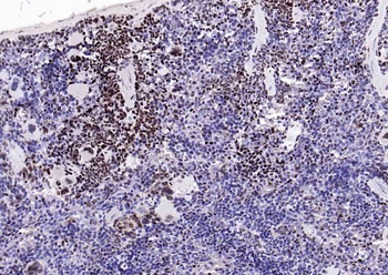 Bub3 Recombinant Rabbit Monoclonal Antibody