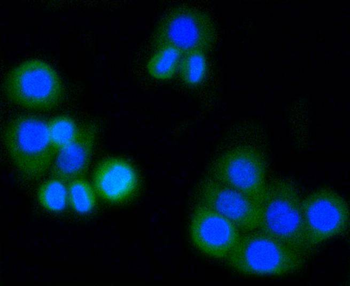 MMP14 Recombinant Rabbit Monoclonal Antibody
