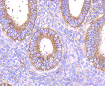 MMP14 Recombinant Rabbit Monoclonal Antibody
