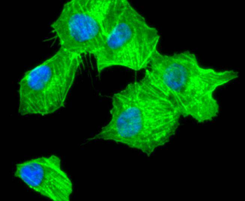 Alpha smooth muscle Actin Recombinant Rabbit Monoclonal Antibody